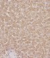 SERPINA6 Antibody (Center)